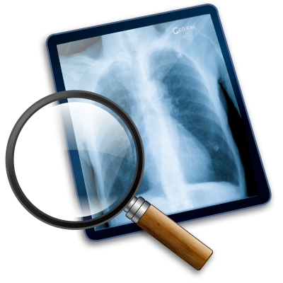 osirix dicom image library osirix dicom image library